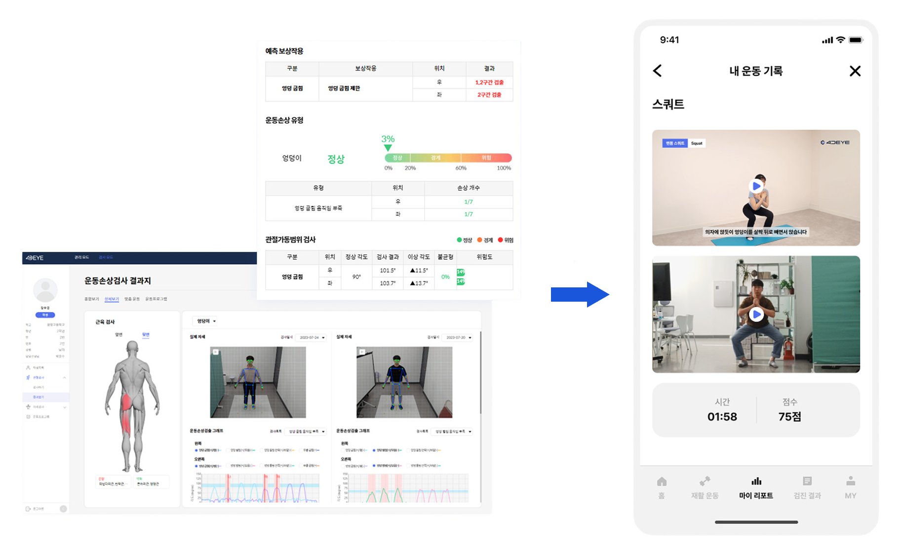 4DEYE Dx 운동손상검사 결과지에서 DTx 내 운동기록 영상으로 이어지는 화면