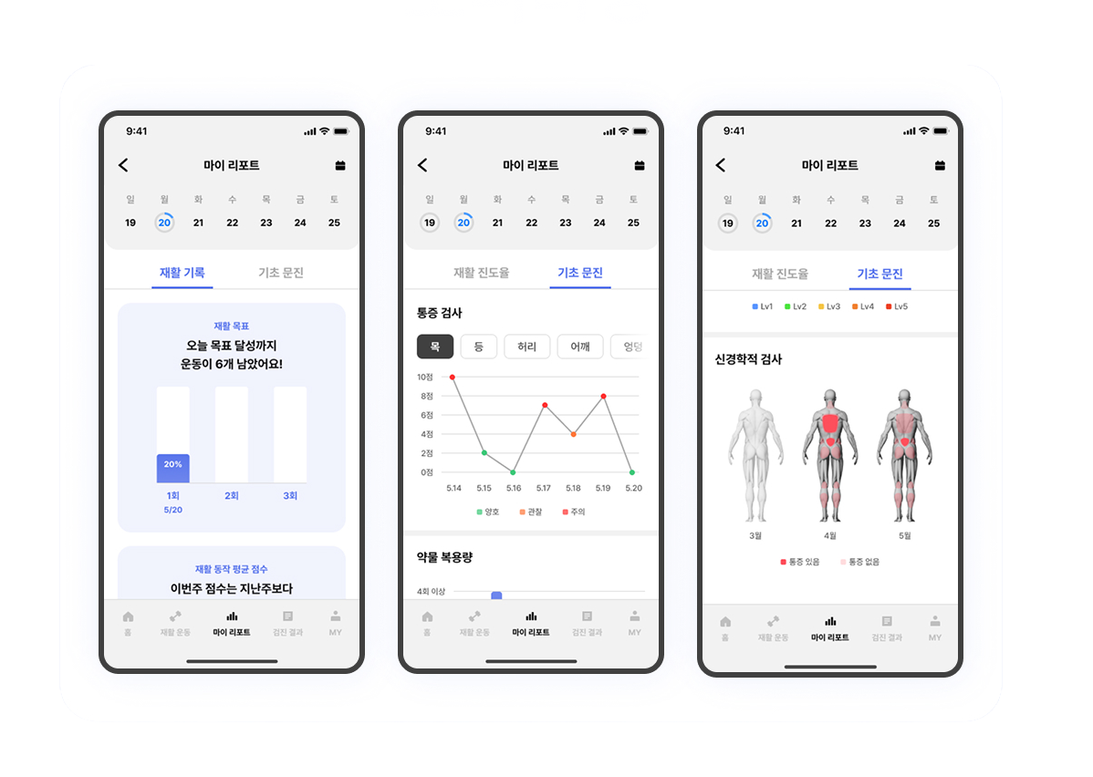 4DEYE DTx 마이 리포트 — 재활 기록·기초 문진 모니터링 화면